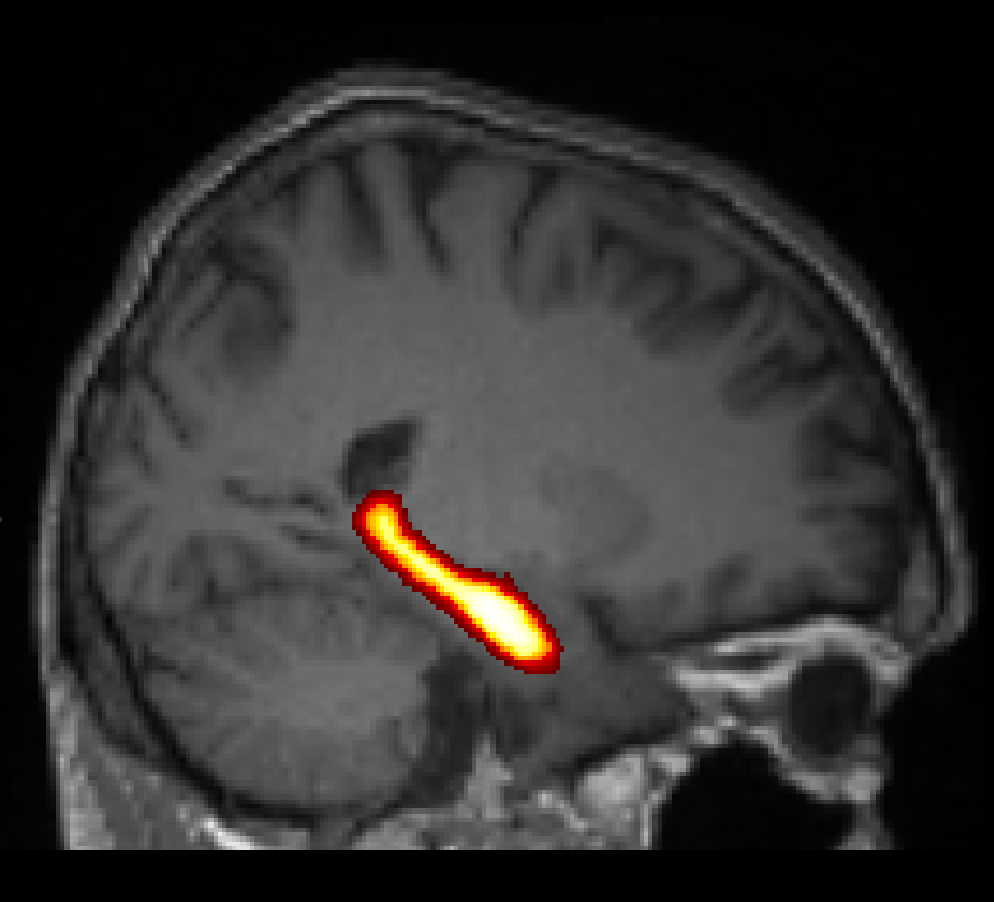 Image of hippocampus