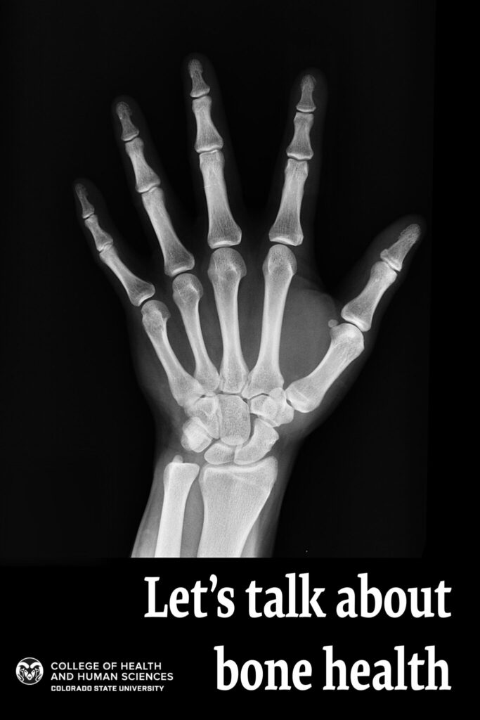 Let's talk about bones - picture of bones in an xray of a left hand