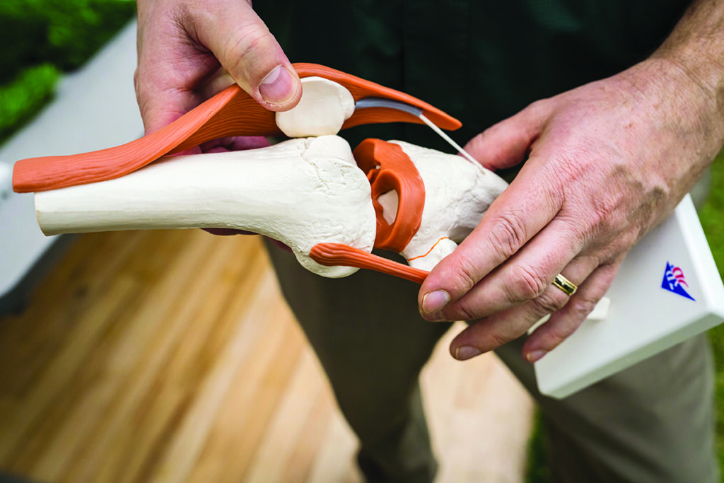 Two hands holding an anatomical model of a human knee joint.